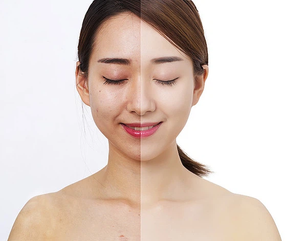 Whitening Whitening