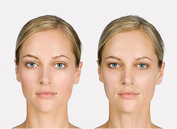 Anti-Aging Anti-Aging